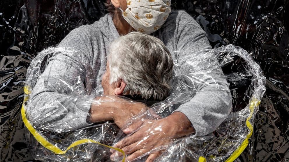 “Një përqafim në kohë pandemie” fiton çmimin e fotografisë së vitit në botë