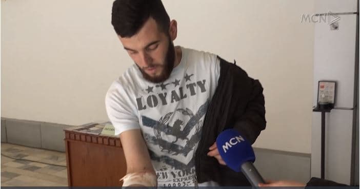 Rrëfehet i plagosuri në xhami (VIDEO)
