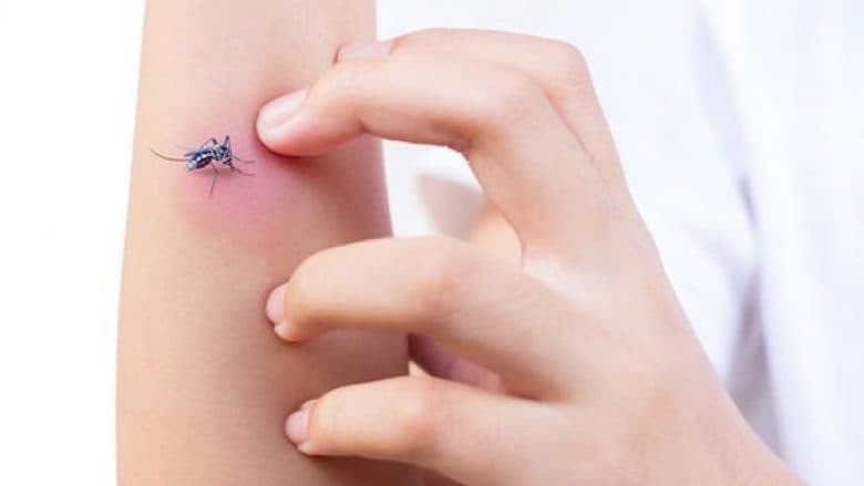 Problemi i verës, mbani larg mushkonjat me këtë përbërje