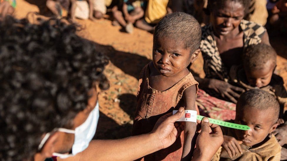 Madagaskari në prag urie, shkak thatësira