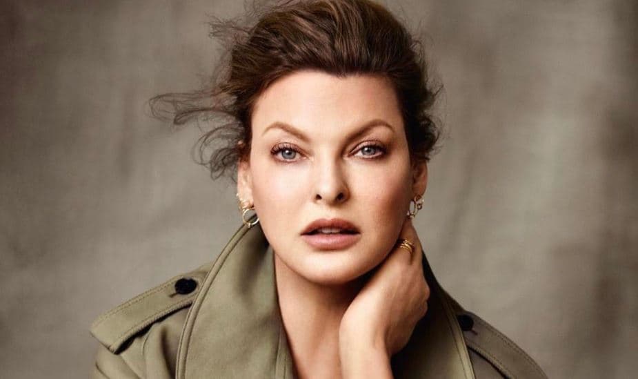 “Jam e lodhur duke jetuar”, supermodelja rrëfen si u shpërfytyrua