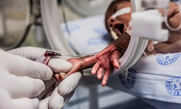 Ndotja e ajrit ka shkaktuar 6 milionë lindje të parakohshme në vit