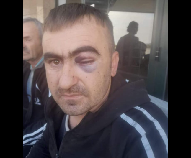 Dhunoi qytetarin në Lushnjë, pezullohet nga detyra efektivi i policisë