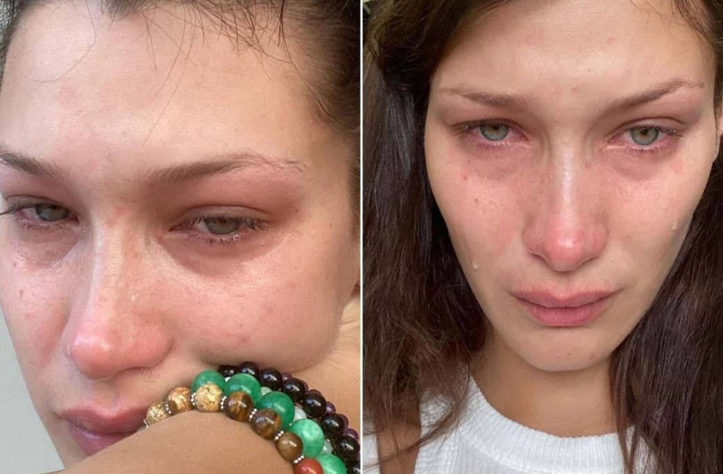 Bella Hadid thotë se ajo qan "çdo ditë" dhe "çdo natë"