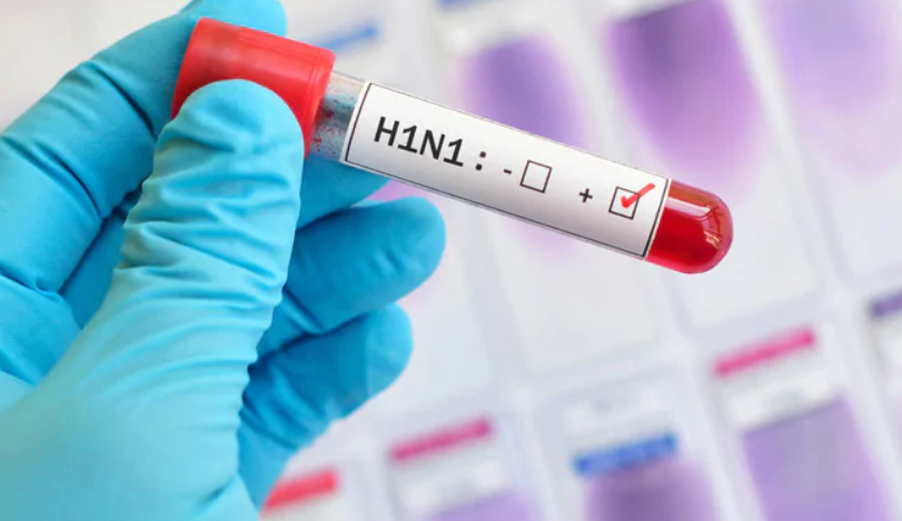 Konfirmohen 2 rastet e para të gripit H1N1 në Shqipëri