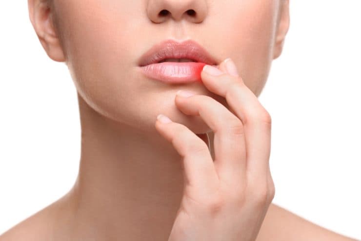 Keni dëgjuar për virusin herpes? Ai mund të prekë sistemin tonë nervor