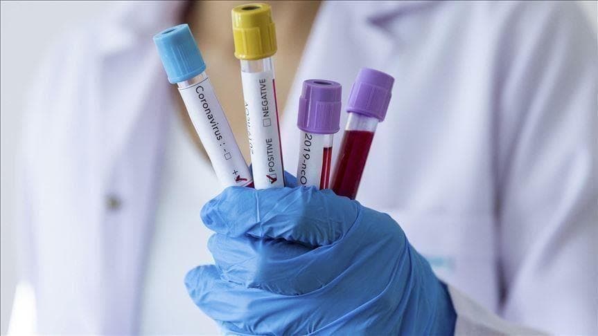 Covid në Kosovë/ 11 të infektuar dhe asnjë viktimë në 24 orë