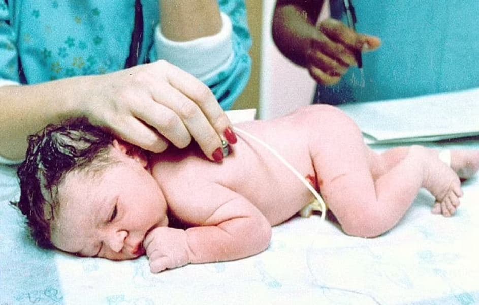 Foshnja e parë IVF në Amerikë mbush sot 40-vjeç