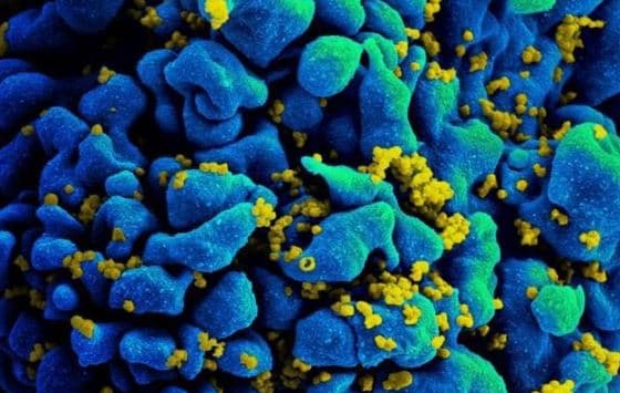 Ilaçi kundër kancerit mund të eliminojë virusin latent HIV