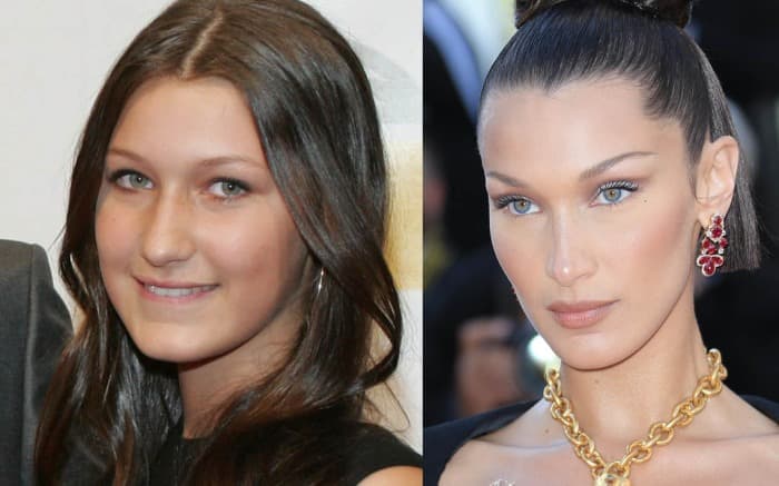 Pas vitesh aludime, Bella Hadid pranon se ka kryer operacione plastike