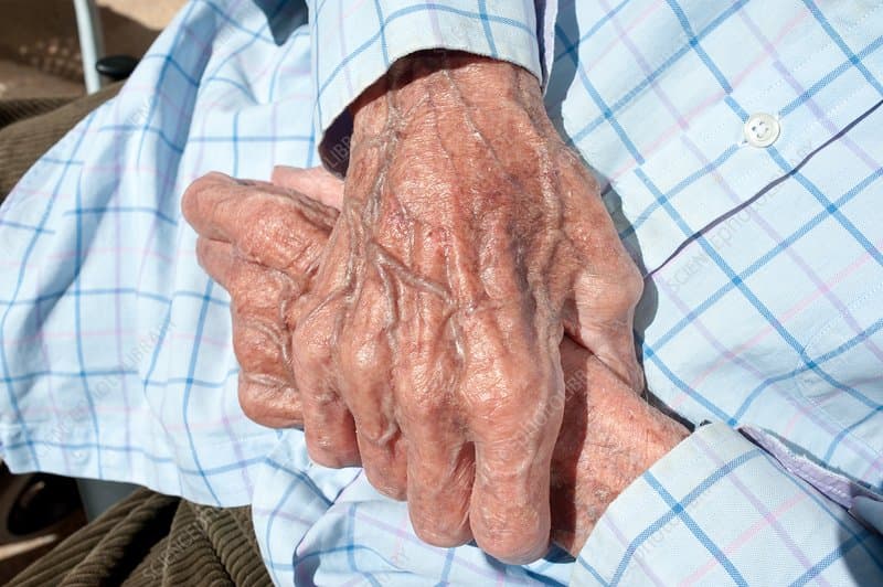 Vlorë, nipi plagos gjyshin me mjet prerës