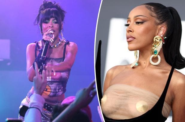 Doja Cat anulon turnet për shkak të një operacioni