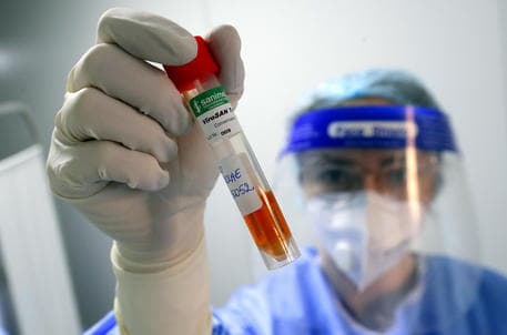 Covid 19, regjistrohen mbi 6.3 milionë viktima në të gjithë botën