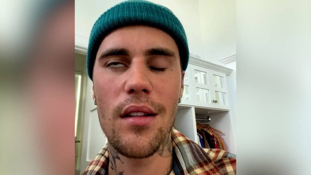 Çfarë duhet të dini për virusin që ka prekur Justin Bieber