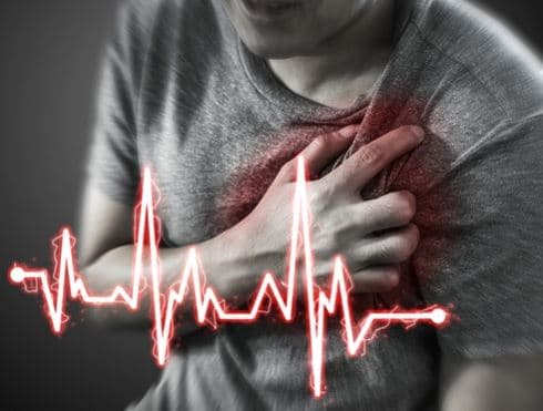 Studiuesit po testojnë proteinën që mund të jetë në gjendje të pastrojë arteriet e zemrës