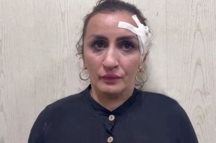 Nëna shet djalin 5 ditësh për 3400 euro, donte të bënte hundën