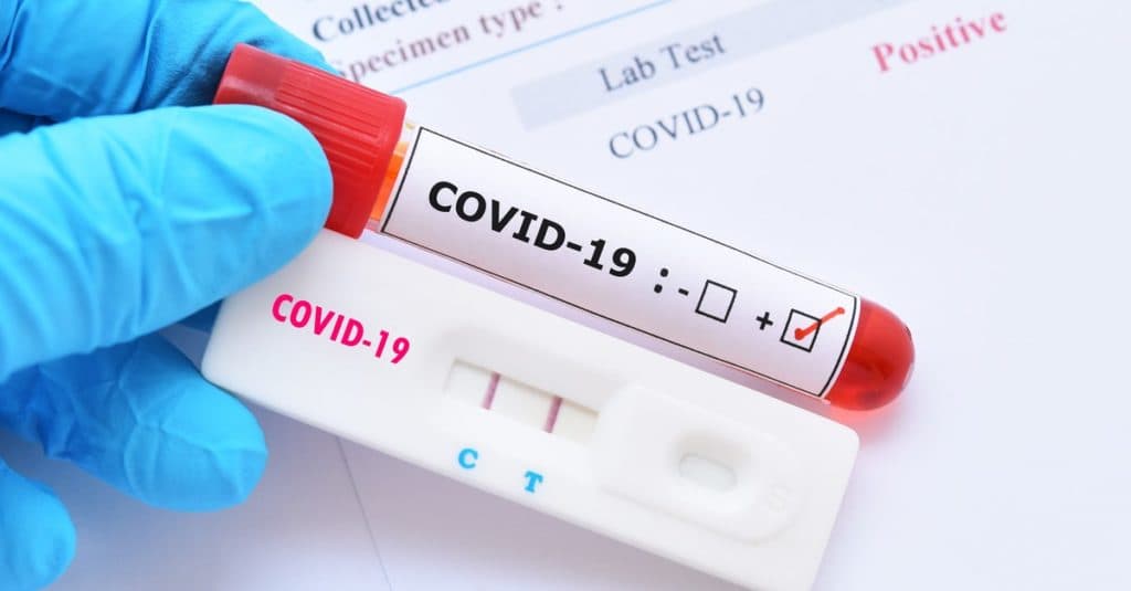 COVID-19/ 354 infektime të reja në 24 orë, humb jetën 53-vjeçarja