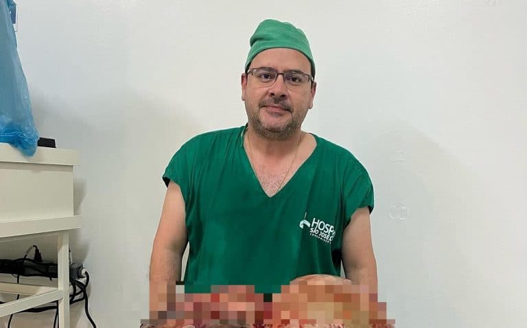 Brazil, një ekip mjekësh i heqin tumorin 40 kg një gruaje