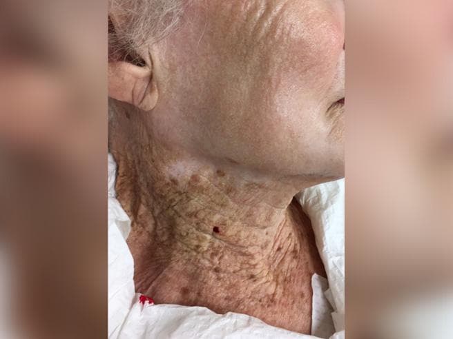 Prova që tregon sa i rëndësishëm është kremi kundër diellit