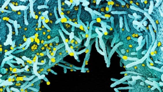 Një tjetër virus i ngjashëm me Covid zbulohet te lakuriqët rusë