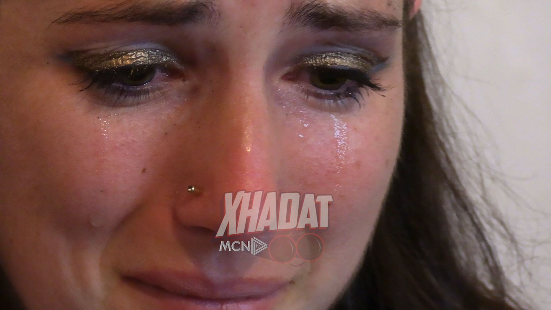 Viktimë e bullizmit, vajza shkul dhëmbët (VIDEO)