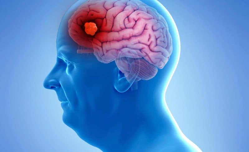Diagnoza e demencës rrit rrezikun e vetëvrasjes për ata nën moshën 65 vjeç