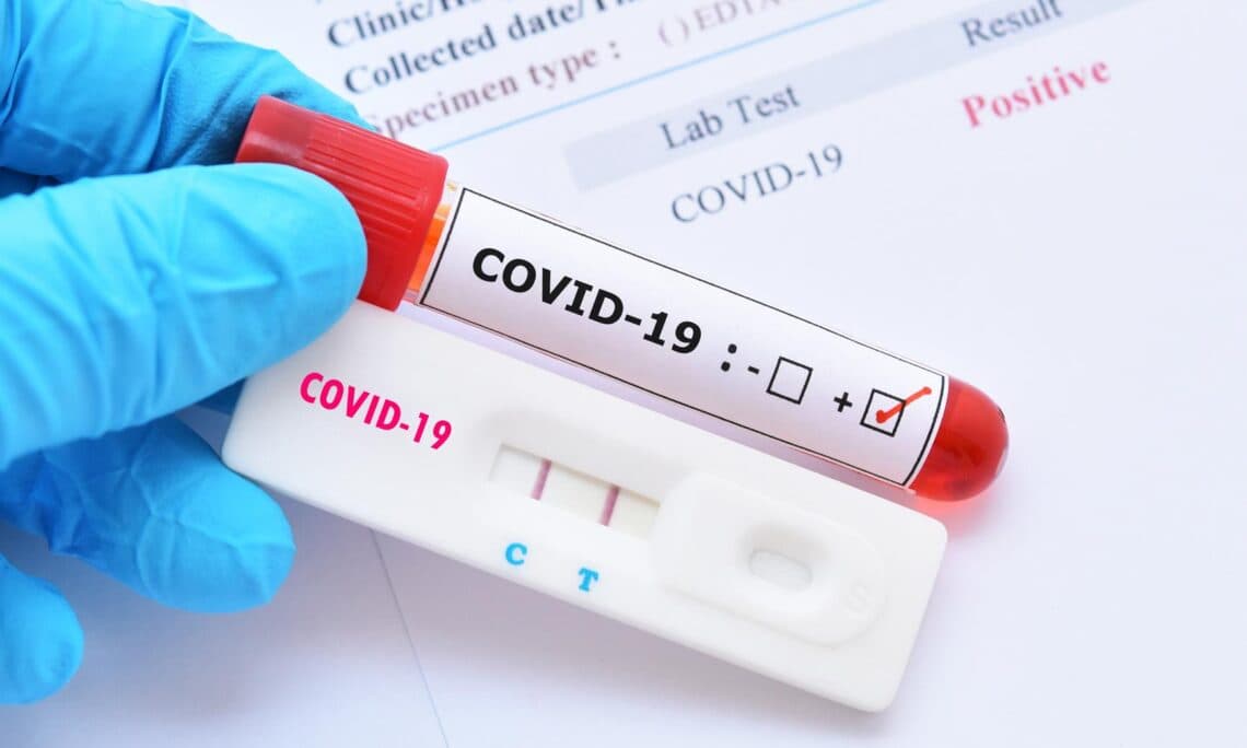 Covid/ 18 raste të reja në 24 orët e fundit