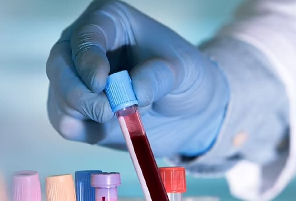Ky test i gjakut mund të zbuloj herët kancerin e gjirin