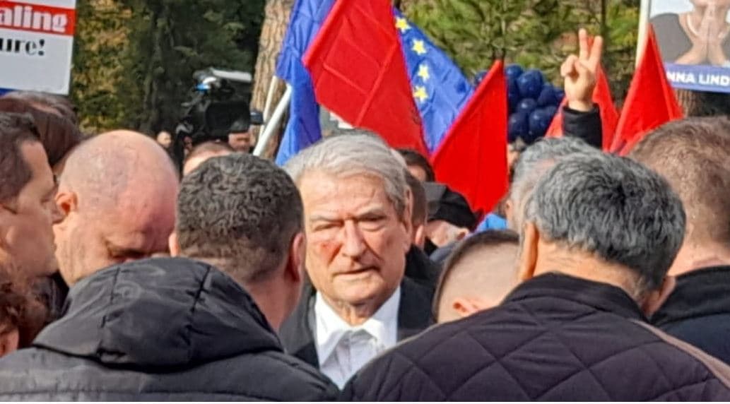 Incidenti, Nazarko: Uroj të jetë incident i izoluar, akt i dënueshëm të sulmosh një plak