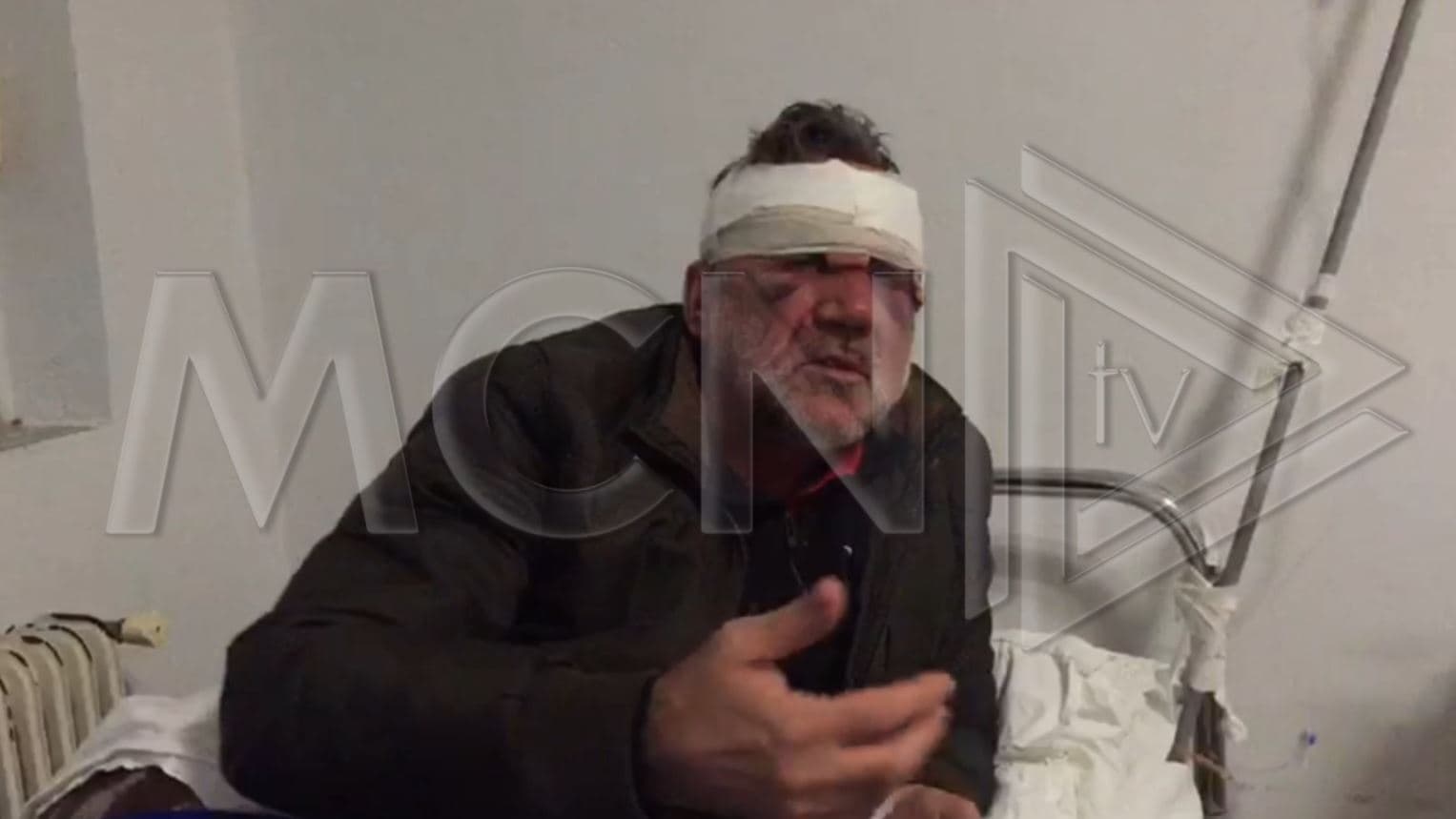 Dhunohet mësuesi në Tepelenë, tre persona e thërrasin dhe e fusin në makinë: Më thanë do më qerasnin (VIDEO)