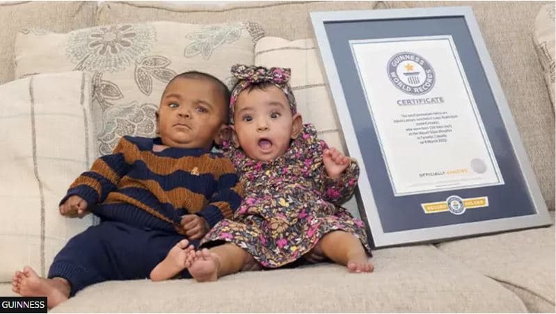 Binjakët e lindur para kohe hyn në librin Guinness