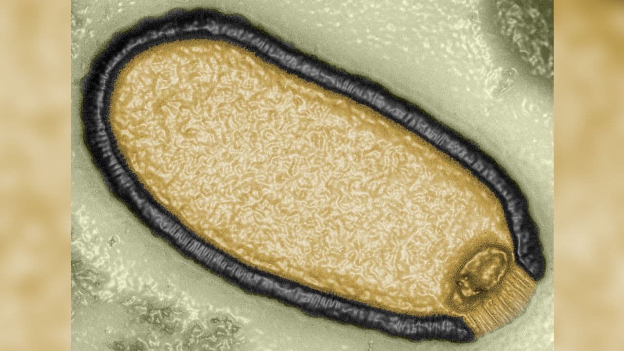 Shkencëtarët ringjallin një virus 'zombi', kaloi 48,500 vjet i ngrirë