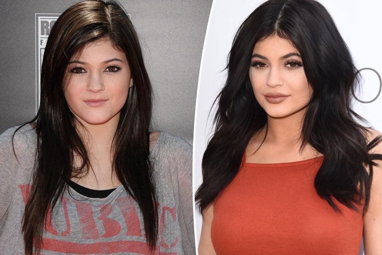 “Kam mbushur buzët”, Kylie Jenner: Nuk kam bërë asnjë operacion plastik