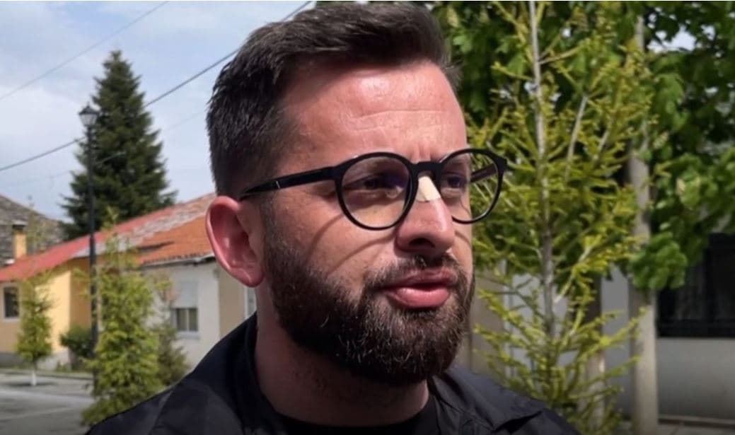 Kryebashkiaku i Kolonjës, Erion Isai paraqitet në SPAK