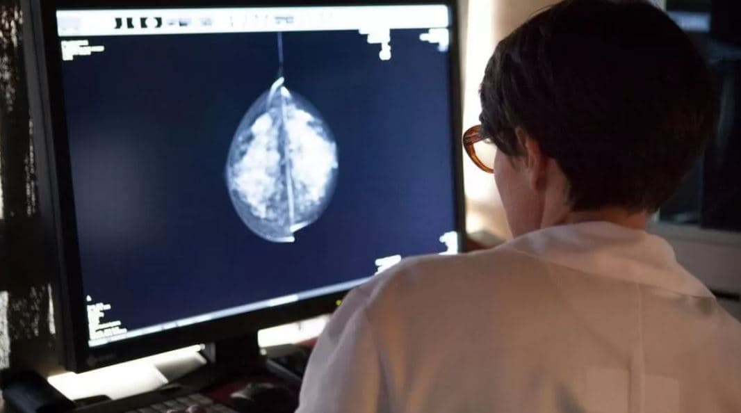 Inteligjenca artificiale, të dhëna premtuese në ekzaminimin e kancerit të gjirit