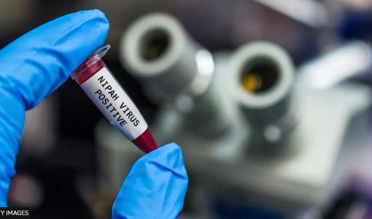 India në alarm pas dy vdekjeve nga virusi Nipah