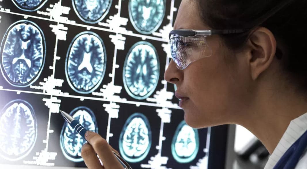 Shkencëtarët zbulojnë se si qelizat e trurit vdesin nga Alzheimeri
