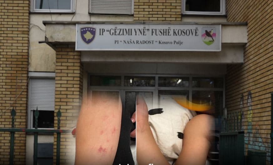  Dhunimi i 3-vjeçarit në Fushë Kosovë/ Masë disiplinore për drejtoreshën, pezullim nga puna të tri punëtoreve