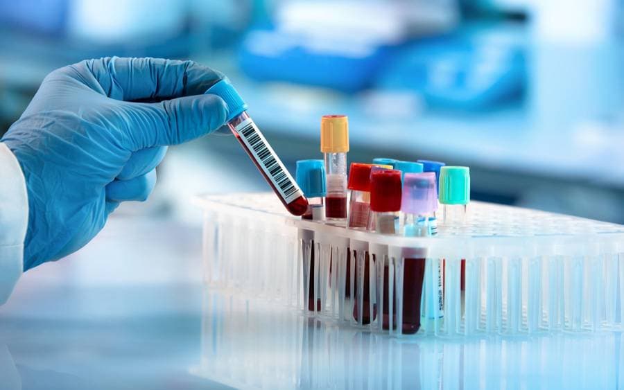 Një analizë e thjeshtë gjaku për të diagnostikuar kancerin