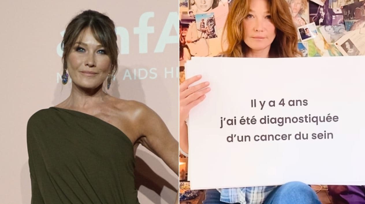 Carla Bruni zbulon se është diagnostikuar me kancer gjiri