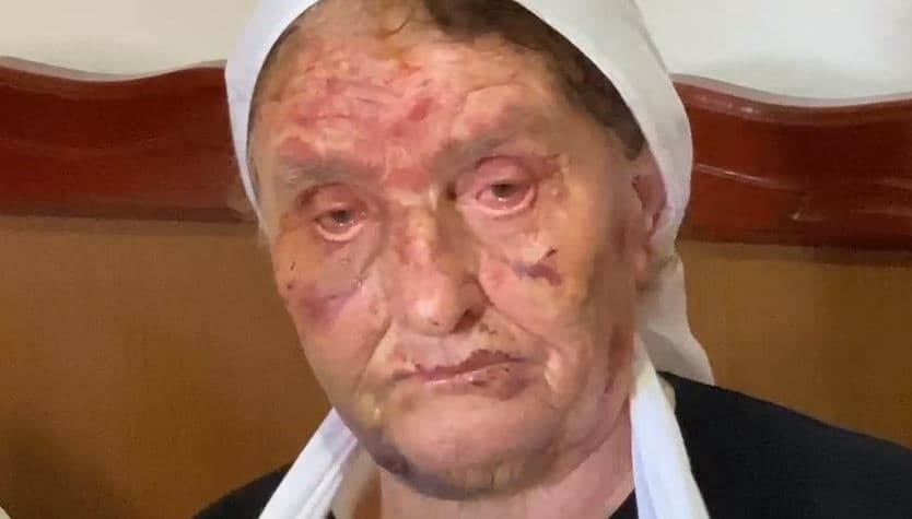 Divjakë/ 82-vjeçarja dhunohet barbarisht nga hajduti që hyri t'i vidhte banesën: Nuk më pyeti për asgjë, vetëm më torturonte