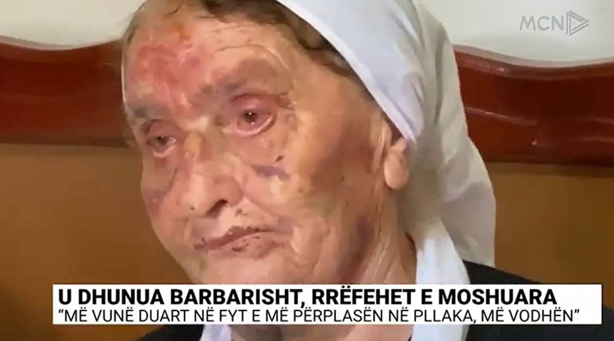 U dhunua barbarisht, e moshuara rrëfen ngjarjen: Më vunë duart në fyt e më përplasën në pllaka, më vodhën (VIDEO)