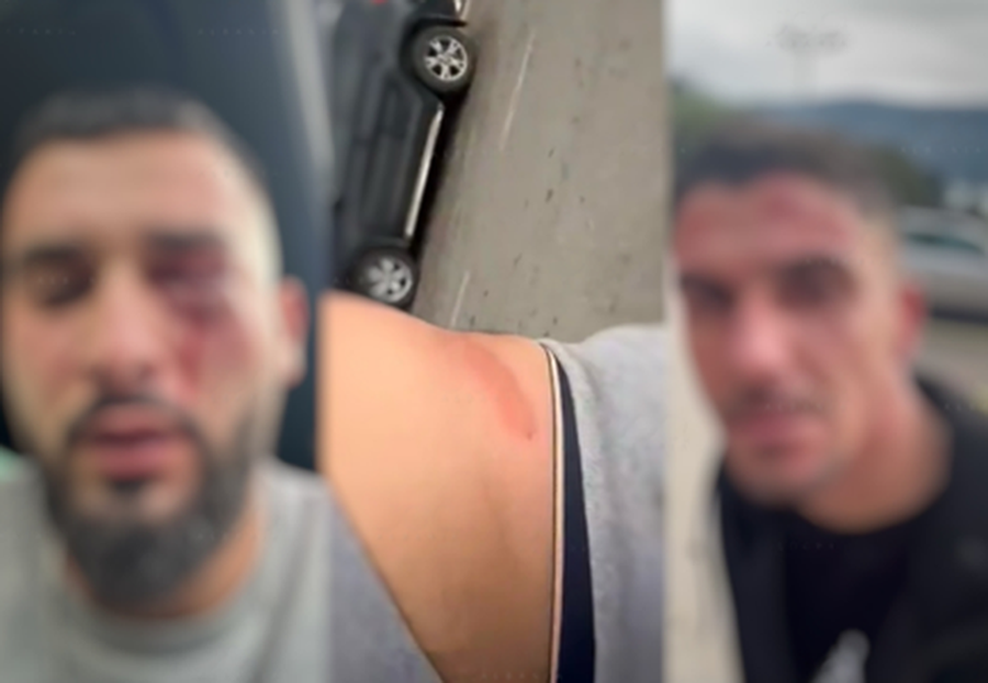 U dhunuan në Malin e Zi, policia: Tre shqiptarët janë rikthyer në atdhe, u shoqëruan me efektivë deri në kufi