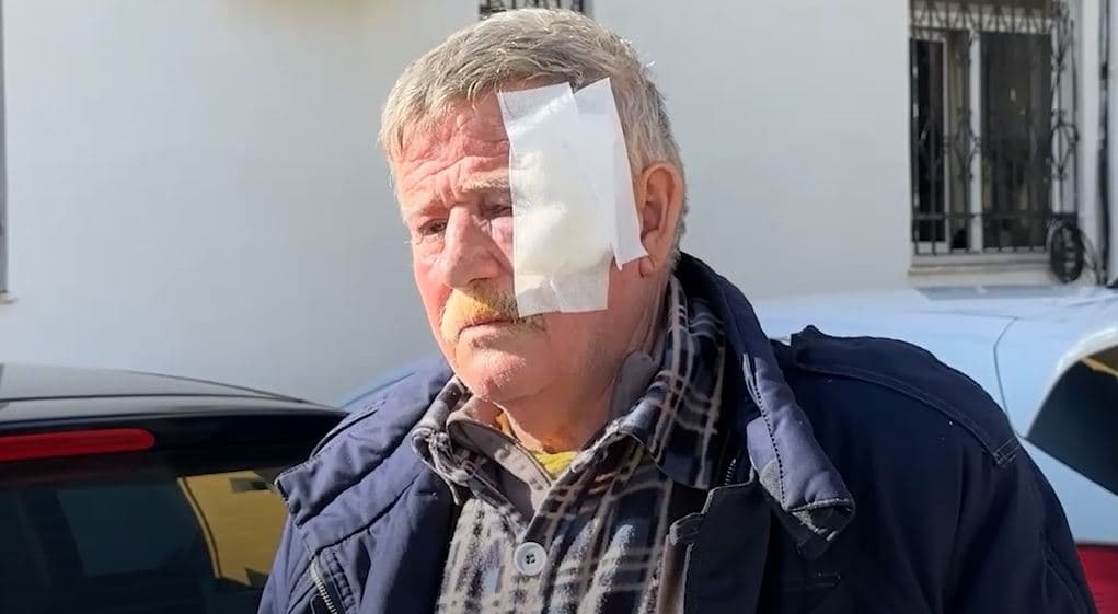 Goditën me lopatë bashkëfshatarin/ Arrestohen babë e bir, ishin në konflikt për pronën (VIDEO)