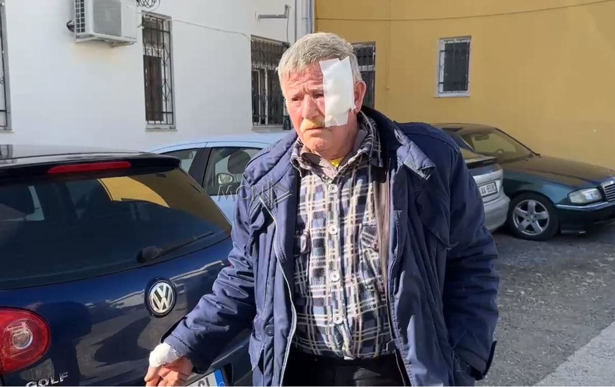  Sherr për pronën në Lezhë, plagoset një person