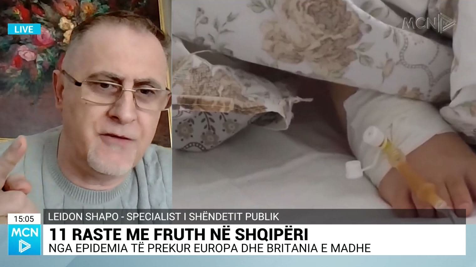 Shapo: Një person i prekur nga fruthi, infekton 12-18 vetë. 11 rastet në Shqipëri, vetëm maja e ajsbergut (VIDEO)