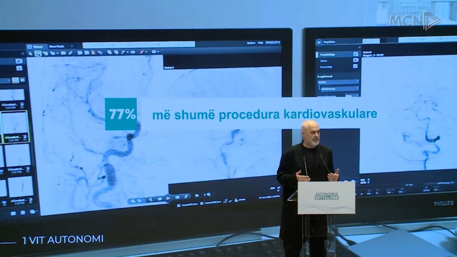 Mjekët, shërbim privat në spitalet publike/ Rama: Do marrin 70% të pagesës, jo më rrogëtarë (VIDEO)