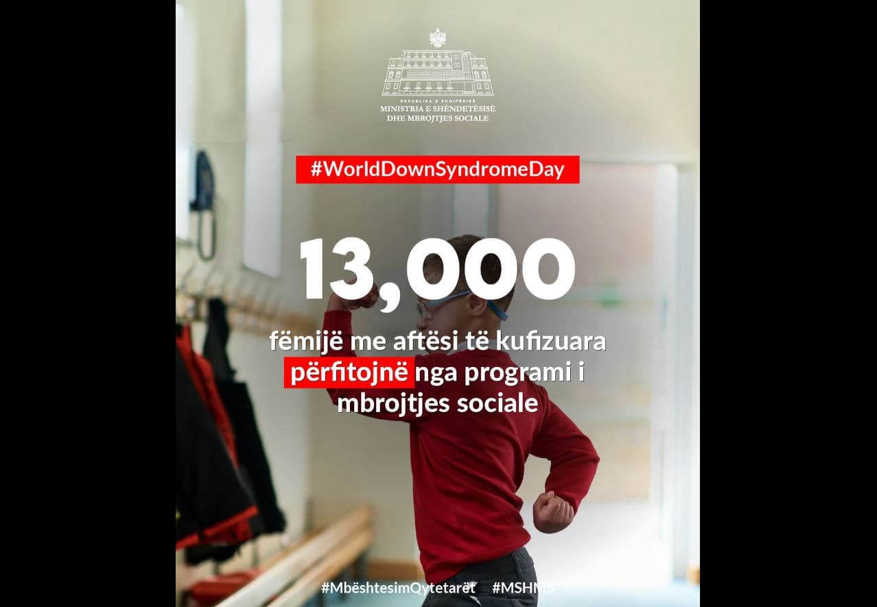 Dita Botërore e Sindromës Down/ Koçiu: Rreth 13 mijë fëmijë në vend me programin e mbrojtjes sociale