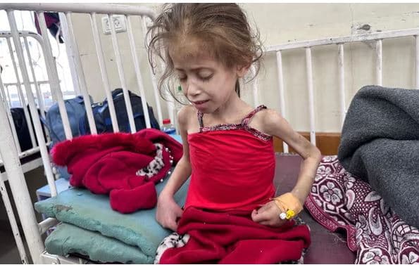 'Atje është vdekja', foshnjat dhe fëmijët në Gaza po vdesin nga uria