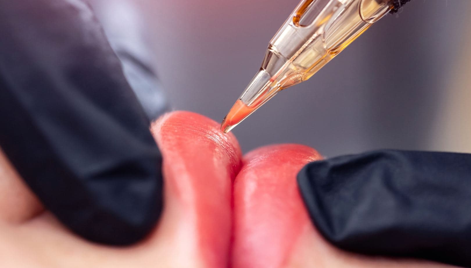 SHBA, regjistrohen rastet e para të infektimit me HIV përmes gjilpërave kozmetike